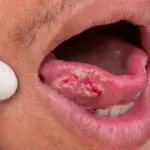 Iguazú – DOS HOTELES ARGENTINOS COMPITEN POR EL PREMIO AL MEJOR DE SUDAMÉRICA